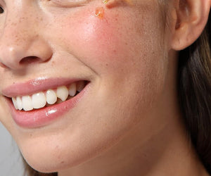 Cliganic Organic Rosehip Seed Oil for Face Carrier Oil for Skin, Hair & Nails